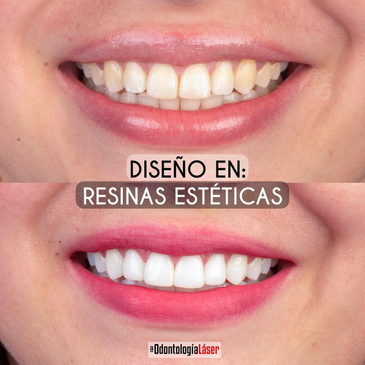 Slider image (3) Odontologia Laser